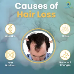 Hair loss can be caused by many factors, including genetics, stress, poor nutrition, and hormonal changes. Identifying the cause is key to finding the right treatment.