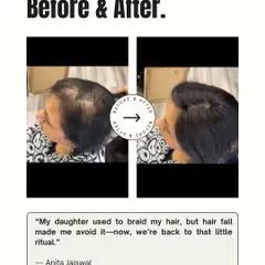 Simple moments like a daughter braiding her mother's hair are precious. Anita was able to bring back this cherished ritual after a hair topper restored the volume she had lost.