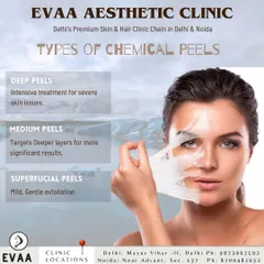 An educational visual explaining the different types of chemical peels we offer: Superficial (mild), Medium (for significant results), and Deep (for severe issues).