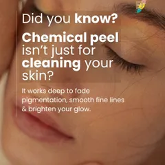 A chemical peel is much more than a surface-level cleaning. I use professionally formulated peels that work deep within the skin to fade pigmentation, smooth fine lines, and significantly brighten your overall complexion.