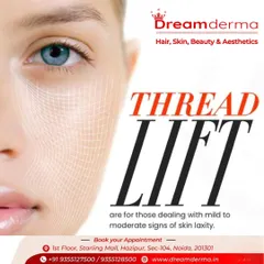 A close-up look at how a Thread Lift works. This treatment is ideal for addressing mild to moderate skin laxity by providing a subtle yet effective lift to sagging areas.