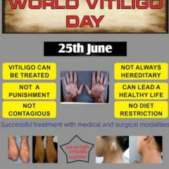 This World Vitiligo Day post clarifies common myths. Vitiligo is a treatable condition, not contagious, and with the right medical and surgical care, life can be colorful again.