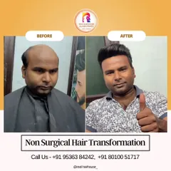This client's thumbs-up shows his happiness with the immediate results. My goal is always to restore not just hair, but also confidence, with a comfortable and natural-looking hair system.