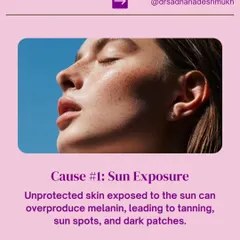The number one cause of hyperpigmentation is unprotected sun exposure. UV rays trigger an overproduction of melanin, which leads to tanning, sun spots, and dark patches. Consistent use of sunscreen is your first line of defense.