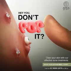 It can be tempting, but please don't pop your pimples. Popping can lead to more inflammation, infection, and permanent scarring. I offer effective acne treatments that heal breakouts safely.