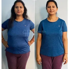 This is Rashmi, who lost an incredible 15 kg in just 3 months with me. Her transformation is a perfect example of what consistency with simple home workouts and a sustainable diet can achieve, especially after pregnancy.