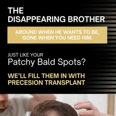 Is your patchy bald spot like the disappearing brother who's gone when you need him? We can fill those spots in with a precision transplant. Tag your sibling and tell us which hair problem they'd be!