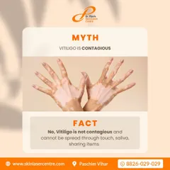 It is very important to understand that vitiligo is not contagious. You cannot get it from touching someone, sharing items, or through any other form of contact. Spreading facts helps us overcome the social stigma associated with the condition.