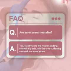 FAQ: Are acne scars treatable? Yes, absolutely. We use a combination of treatments like microneedling, chemical peels, and laser resurfacing to significantly reduce the appearance of acne scars.