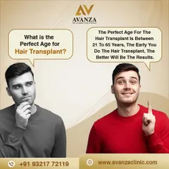 A common question is about the perfect age for a hair transplant. While it can be done between 21 to 65 years, addressing hair loss earlier often leads to better, more satisfying long-term results.