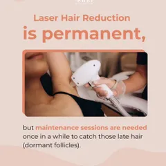 While laser hair reduction is permanent, occasional maintenance sessions are needed to target any new hair from dormant follicles that may activate over time due to hormonal changes.