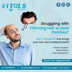 If you are concerned about thinning hair or developing bald patches, a hair transplant can restore both your hair and your confidence. Our procedure is designed to be painless and deliver a natural hairline with long-lasting results.
