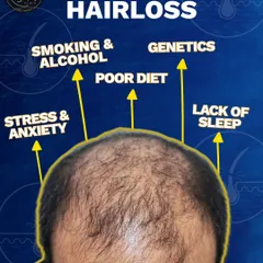 Hair loss has many causes, from genetics and stress to poor diet and lack of sleep. Understanding the root cause is the first step toward finding the right solution.