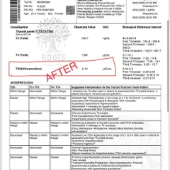 This "after" report for the same patient shows their TSH level reduced to a healthy 4.10 within a month of starting my prescribed Ayurvedic treatment and lifestyle changes.