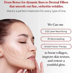 We offer a variety of treatments for every type of line, from Botox for dynamic wrinkles to advanced therapies like CO2 Laser Resurfacing and RF Microneedling that boost collagen and improve overall skin texture.
