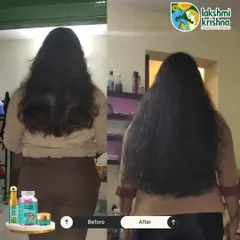A picture is worth a thousand words. This before-and-after shot shows the incredible increase in hair length and volume a customer achieved using our Hair Growth Booster Kit.