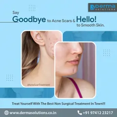 We specialize in transforming skin texture and reducing the appearance of acne scars. This visual represents the journey we take with our clients toward smoother, clearer skin.
