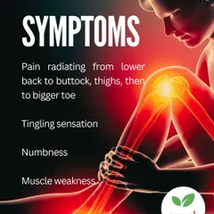 Recognizing the symptoms of Sciatica is key to getting the right treatment. These include pain radiating from the lower back to the toe, a tingling sensation, numbness, and muscle weakness in the affected leg.