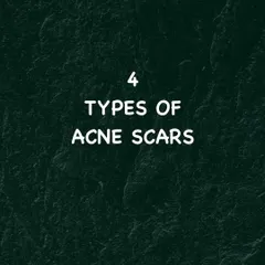 Understanding your acne scars is the first step to treating them. Here, I introduce the four main types of acne scars that I diagnose and manage in my clinic.