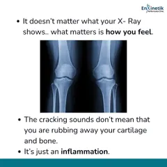 An X-ray showing joint space narrowing doesn't define your capabilities. What truly matters is how you feel and function. Cracking sounds don't mean your cartilage is rubbing away; it's often just a sign of inflammation, which we can manage with the right plan.