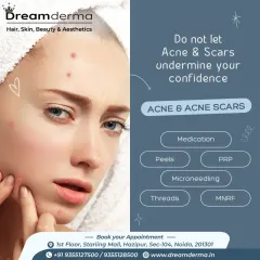 Don't let acne and scars undermine your confidence. We offer a complete toolkit of solutions including medication, peels, PRP, microneedling, threads, and MNRF. Our dermatologists will help you choose the right path for your skin.