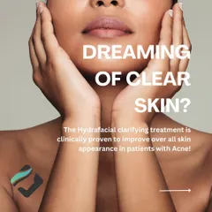 Dreaming of clear skin? The Hydrafacial clarifying treatment is clinically proven to improve the overall appearance of skin in patients with acne.