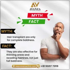 Myth: Hair transplants are only for complete baldness. Fact: They are highly effective for thinning areas and receding hairlines, not just full baldness. We can help at various stages of hair loss.