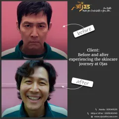 This before and after meme perfectly captures the feeling of transformation our clients experience. It's not just about looking better, it's about feeling happier and more confident.