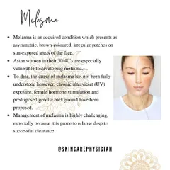 Melasma is a common but complex pigmentation issue, especially for Indian skin. I focus on a comprehensive approach that addresses its causes, including UV exposure and hormonal changes, to manage it effectively.