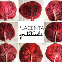The placenta, or "tree of life," is a remarkable organ that you grow. It nourishes and protects your baby for nine months, and each one is as unique as a fingerprint.