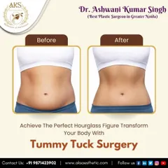A tummy tuck is more than just fat removal; it's about restoring the shape of your abdomen. This visual demonstrates the goal of the procedure: to remove loose skin and tighten the underlying muscles, creating a smoother and firmer stomach, often desired after pregnancy or significant weight loss.