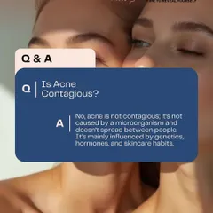 Myth busted: Is acne contagious? No. This graphic explains that acne is influenced by genetics, hormones, and skincare habits, not by spreading from person to person.
