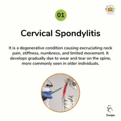 Cervical Spondylitis causes debilitating neck pain and stiffness. My treatments focus on addressing this degenerative condition to reduce pain and improve movement, offering a natural alternative for managing this common ailment.