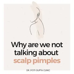 Scalp pimples can be painful and affect self-esteem. I outline a comprehensive treatment plan that includes lifestyle changes, proper hair styling habits, and specific shampoos to manage this common condition.