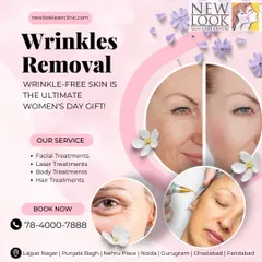 A clear look at the results of our targeted wrinkle removal treatments. We focus on smoothing fine lines and deeper wrinkles to restore a naturally youthful and rested appearance, as seen in this before-and-after comparison.