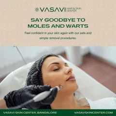 In my clinic, every procedure for mole or wart removal is performed using sterile equipment and proven dermatological techniques. This ensures the treatment is not only effective but also safe and comfortable for the patient.