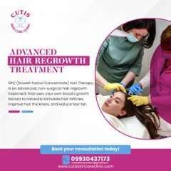 A patient undergoing our advanced GFC hair therapy. This image shows the non-surgical process where we use the patient's own blood's growth factors to naturally stimulate hair follicles, improve thickness, and reduce hair fall.