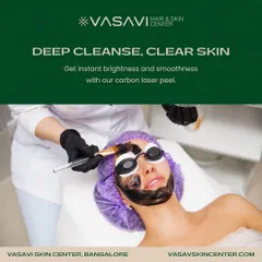 This image shows a Carbon Laser Peel in progress. This is an excellent treatment for achieving a deep cleanse and instant brightness. It is particularly effective for individuals with oily skin, blackheads, and enlarged pores, helping to create a smoother, clearer canvas.