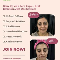 Real results in just one session! This before-and-after from our Face Yoga workshop shows a visible reduction in puffiness and an improved skin glow.