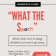 That stubborn patch on your face that will not go away is likely not a tan. It is often melasma, a specific type of hyperpigmentation that requires a targeted dermatological treatment plan.