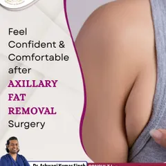 Axillary fat removal targets the bulge of fat in the underarm area. This simple procedure can make a big difference in how clothes fit and boost your confidence in sleeveless tops.