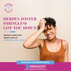 If Herpes Zoster, or Shingles, has got you down, we can help. Our clinic provides expert care, including antiviral therapy and gentle diagnosis, to relieve pain, promote healing, and prevent complications.