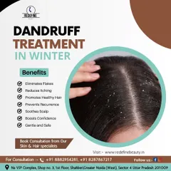 Dandruff can be especially stubborn in the winter. This graphic explains the benefits of our professional dandruff treatment, which soothes the scalp, eliminates flakes, and promotes healthy hair.