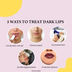Dark lips can be caused by genetics or sun exposure, but there are effective ways to treat them. My approach includes recommending lip balms with SPF, performing in-clinic chemical peels or Q-switched laser sessions, and in some cases, using lip micropigmentation for a temporary color enhancement.