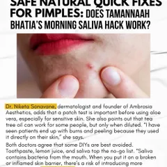 Does the morning saliva hack for pimples work? Absolutely not. As I shared with Manifest Magazine, saliva contains bacteria from the mouth that can introduce more germs to inflamed skin. Always avoid DIYs like this, along with toothpaste or lemon juice.