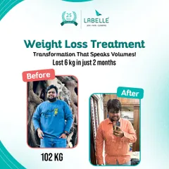 A transformation that speaks for itself. This client achieved a 6 kg weight loss in just two months, showcasing the effectiveness of our tailored weight loss treatments for men.