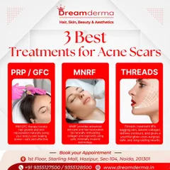 We have three powerful treatments to combat acne scars. This graphic explains how PRP/GFC uses your body's own healing power, MNRF stimulates collagen with minimally invasive technology, and Threads provide a non-surgical lift to smooth scarred areas.