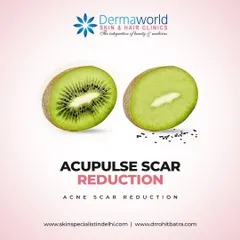 The Acupulse Fractional CO2 laser is a powerful tool for skin resurfacing and acne scar reduction. By creating micro-injuries in the skin, it removes damaged outer layers and triggers a natural healing process that builds new, smooth collagen.