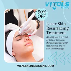 Laser skin resurfacing is a powerful treatment for improving skin texture and tone. It helps you wear less makeup and let your natural skin shine through with confidence.
