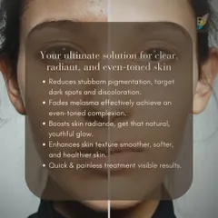 This before-and-after comparison shows the effectiveness of the Q-Switched ND YAG Laser. It is my ultimate solution for reducing stubborn pigmentation, fading melasma, and boosting skin radiance for a smoother, healthier, and more even-toned complexion.